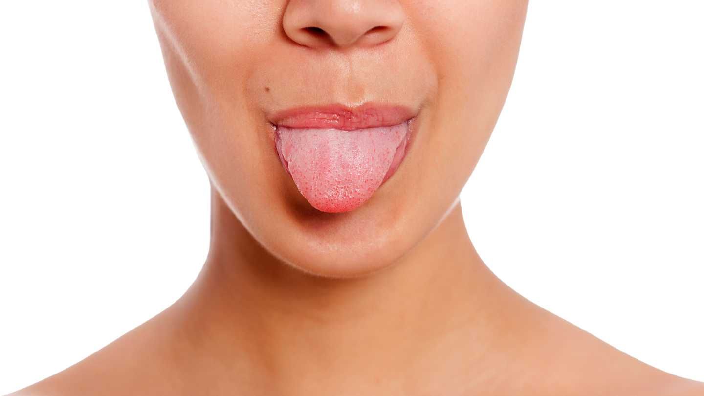 What indicators can the tongue inform us in regards to the well being of the physique?  |  The New Journal